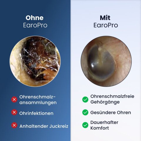 EaroPro image
